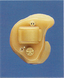 Photo of an in-the-canal hearing aid.